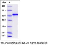 Sino Biological Recombinant Human ADAMTSL1 Protein (His Tag), Quantity: