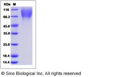 Sino Biological Recombinant Human LAMP2 Protein (His Tag), HPLC-verified,