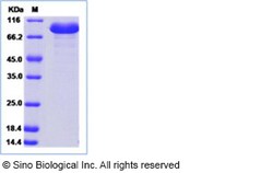 Sino Biological Recombinant Human beta Amylase/AMY2B Protein (hFc Tag),