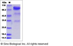 Sino Biological Recombinant Human UNC5H2/UNC5B Protein (ECD, hFc Tag),