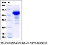 Sino Biological Human NCKIPSD / SPIN90 Protein (GST Tag) 100ug, Quantity: