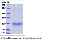 Sino Biological Human GITR / TNFRSF18 Protein (His Tag, ECD) 100ug, Quantity: