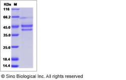 Sino Biological Recombinant Human CYTL1 Protein (mFc Tag), Quantity: Each
