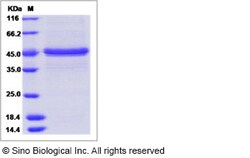 Sino Biological Recombinant Human FKBP11 Protein (mFc Tag), Quantity: Each