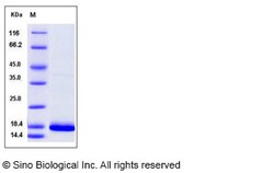 Sino Biological Recombinant Human FGF14 Protein (isoform 1B), Quantity: