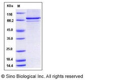 Sino Biological Recombinant Human PRAK/MAPKAPK5 Protein (His & GST Tag),
