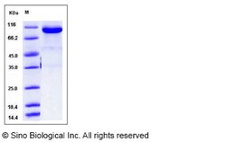 Sino Biological Sus scrofa (Pig) Transferrin / TF Protein (Fc Tag) 100ug,