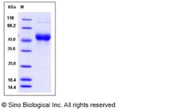 Sino Biological Recombinant Sus scrofa (Pig) CD63 Protein (hFc Tag), Quantity:
