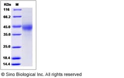 Sino Biological Human TMUB2 Protein (His Tag) 100ug, Quantity: Each of