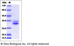 Sino Biological Recombinant Human EPDR1 Protein (His Tag), Quantity: Each