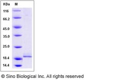 Sino Biological Recombinant Human Calcineurin B/PPP3R1 Protein (His Tag),