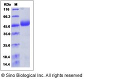Sino Biological Human NAGA / Alpha-N-acetylgalactosaminidase Protein (His