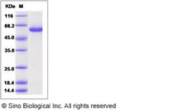 Sino Biological Human Galactolipase / PNLIPRP2 Protein (His Tag) 100ug,