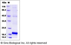 Sino Biological Human Lysozyme 2 / LYZL2 Protein (His Tag) 100ug, Quantity: