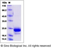 Sino Biological Recombinant Human TMED4 Protein (His Tag), Quantity: Each