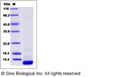 Sino Biological Recombinant Human BOLA1 Protein (His Tag), Quantity: Each