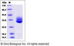 Sino Biological Recombinant Human CTRL Protein (His Tag), Quantity: Each