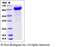 Sino Biological Recombinant Human FAM171B Protein (hFc Tag), Quantity: