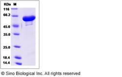 Sino Biological Recombinant Human GALNT2 Protein (His Tag), HPLC-verified,