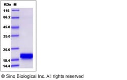 Sino Biological Recombinant Human CNPY2 Protein (His Tag), Quantity: Each