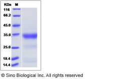 Sino Biological Recombinant Human PILR-alpha/FDF03 Protein, Quantity: Each