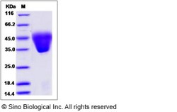 Sino Biological Human KCT2 / C5orf15 Protein (His Tag) 100ug, Quantity: