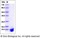 Sino Biological Recombinant Human DNAJC30 Protein (His Tag), Quantity: