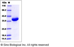Sino Biological Recombinant Human NRN1L Protein (mFc Tag), Quantity: Each