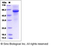 Sino Biological Recombinant Human LMAN2L Protein (hFc Tag), Quantity: Each