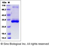 Sino Biological Recombinant Human LMAN2L Protein (His Tag), Quantity: Each