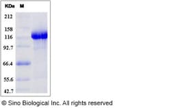 Sino Biological Human C7 / Complement component 7 Protein (Fc Tag) 100ug,