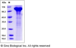 Sino Biological Human C7 / Complement component 7 Protein (His Tag) 100ug,