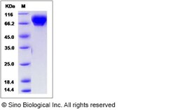 Sino Biological Recombinant Human SLITL2/VASN Protein (His Tag), Quantity: