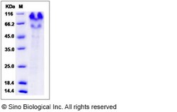 Sino Biological Recombinant Human PSGL-1/CD162 Protein (His Tag), Quantity: