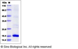Sino Biological Recombinant Human RFK Protein (His Tag), Quantity: Each