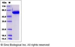 Sino Biological Recombinant Human FUCA1 Protein (His Tag), Quantity: Each