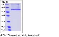 Sino Biological Recombinant Human BPI Protein (His Tag), HPLC-verified,