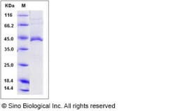 Sino Biological Human APOL1 / apolipoprotein L1 Protein (His Tag) 50ug,