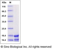 Sino Biological Human RASI-1 / MMP19 Protein 20ug, Quantity: Each of 1