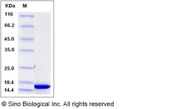 Sino Biological Recombinant Human HMGN3 Protein (His Tag), Quantity: Each