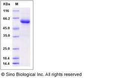 Sino Biological Recombinant Human BPIFA2 Protein (hFc Tag), Quantity: Each