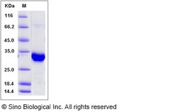 Sino Biological Recombinant Human ING5 Protein (GST Tag), Quantity: Each