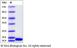 Sino Biological Recombinant Human Tubulin cofactor A Protein, Quantity: