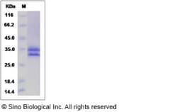 Sino Biological Recombinant Human Factor H-related 2/CFHR2 Protein (His