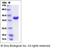 Sino Biological Human SAE1 Protein 50ug, Quantity: Each of 1