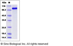 Sino Biological Human IHPK1 Protein (His & GST Tag) 50ug, Quantity: Each