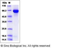 Sino Biological Recombinant Human GBP2 Protein (His Tag), Quantity: Each