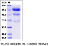Sino Biological Recombinant Human PLBL2 / PLBD2 Protein (His Tag), Quantity: