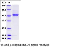 Sino Biological Recombinant Human B3GNT6 Protein (aa 44-384, His Tag),