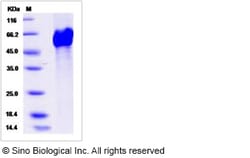 Sino Biological Recombinant Human LRP11 Protein (His Tag), HPLC-verified,